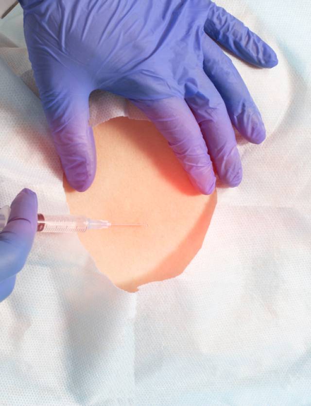 The,Doctor,Performs,An,Epidural,Block,On,A,Patient,For The,Doctor,Performs,An,Epidural,Block,On,A,Patient,For