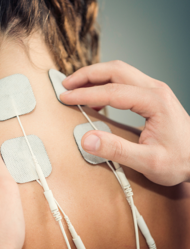Peripheral Nerve Stimulation Peripheral Nerve Stimulation