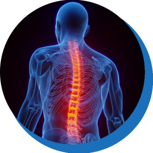 back-pain